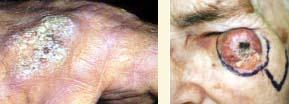 skin2
